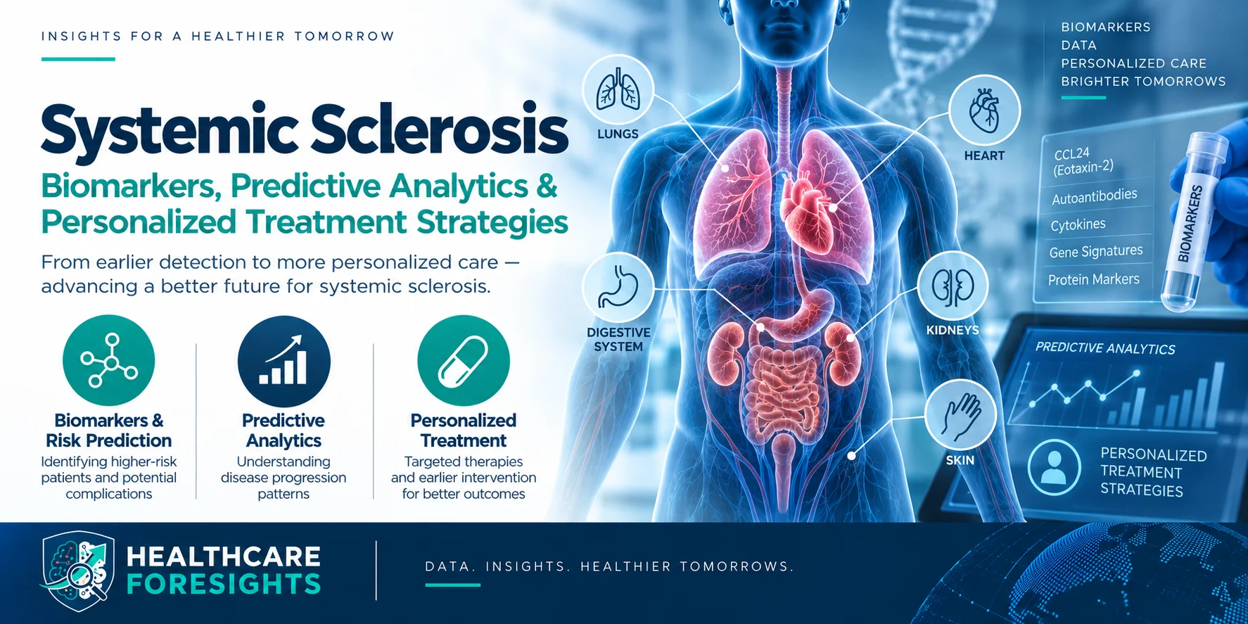 Systemic Sclerosis