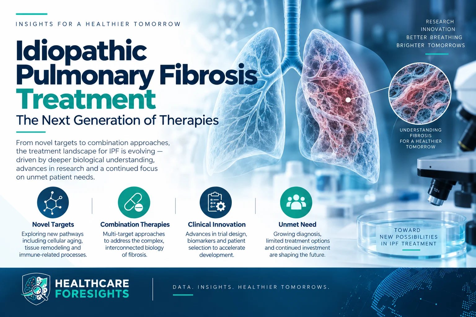 Idiopathic Pulmonary Fibrosis Treatment Insights